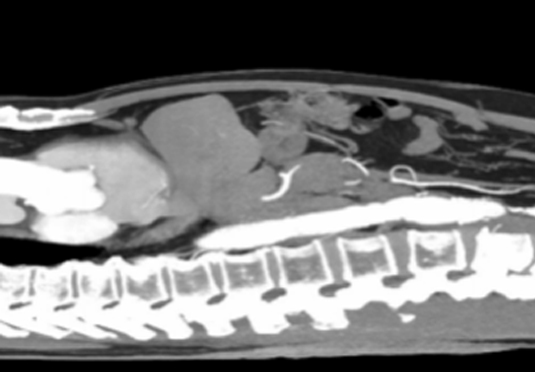 除外惡液質(zhì)晚期 除外惡液質(zhì)晚期